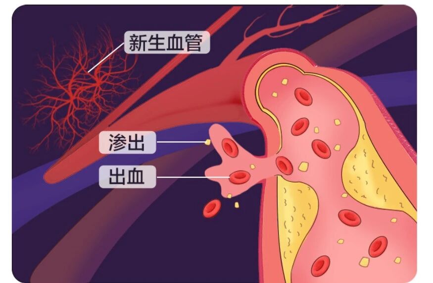 微信圖片_2025-11-13_103650_698 微信圖片_2025-11-13_103650_698